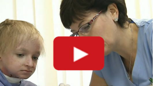 nemoc motylich kridel